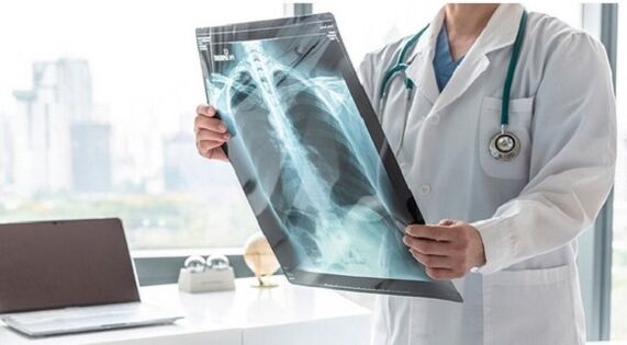 X-ray diagnosis for pain under the left shoulder blade.